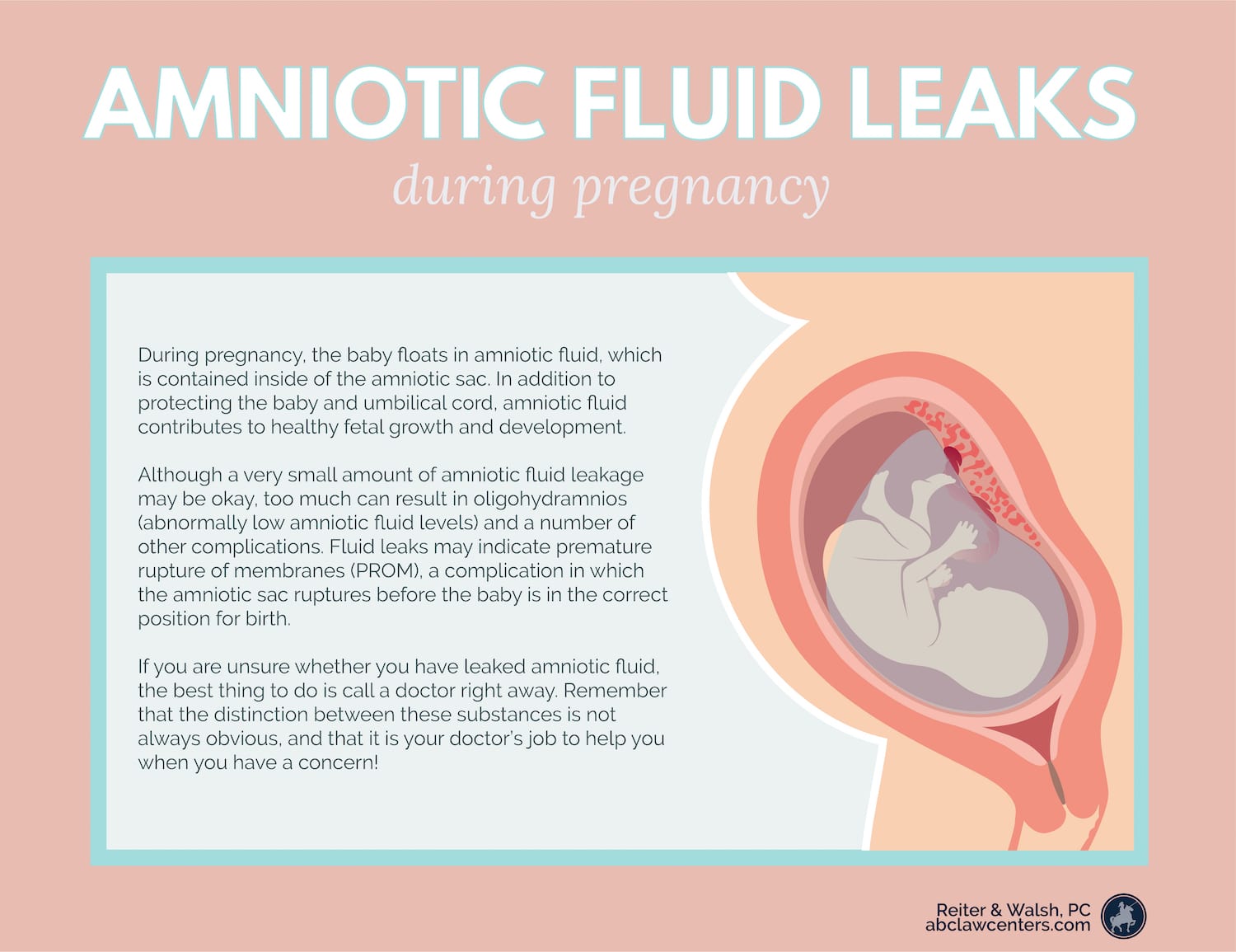 Leaking watery discharge in a gush 15 weeks 2 days - 1st Pregnancy, Forums
