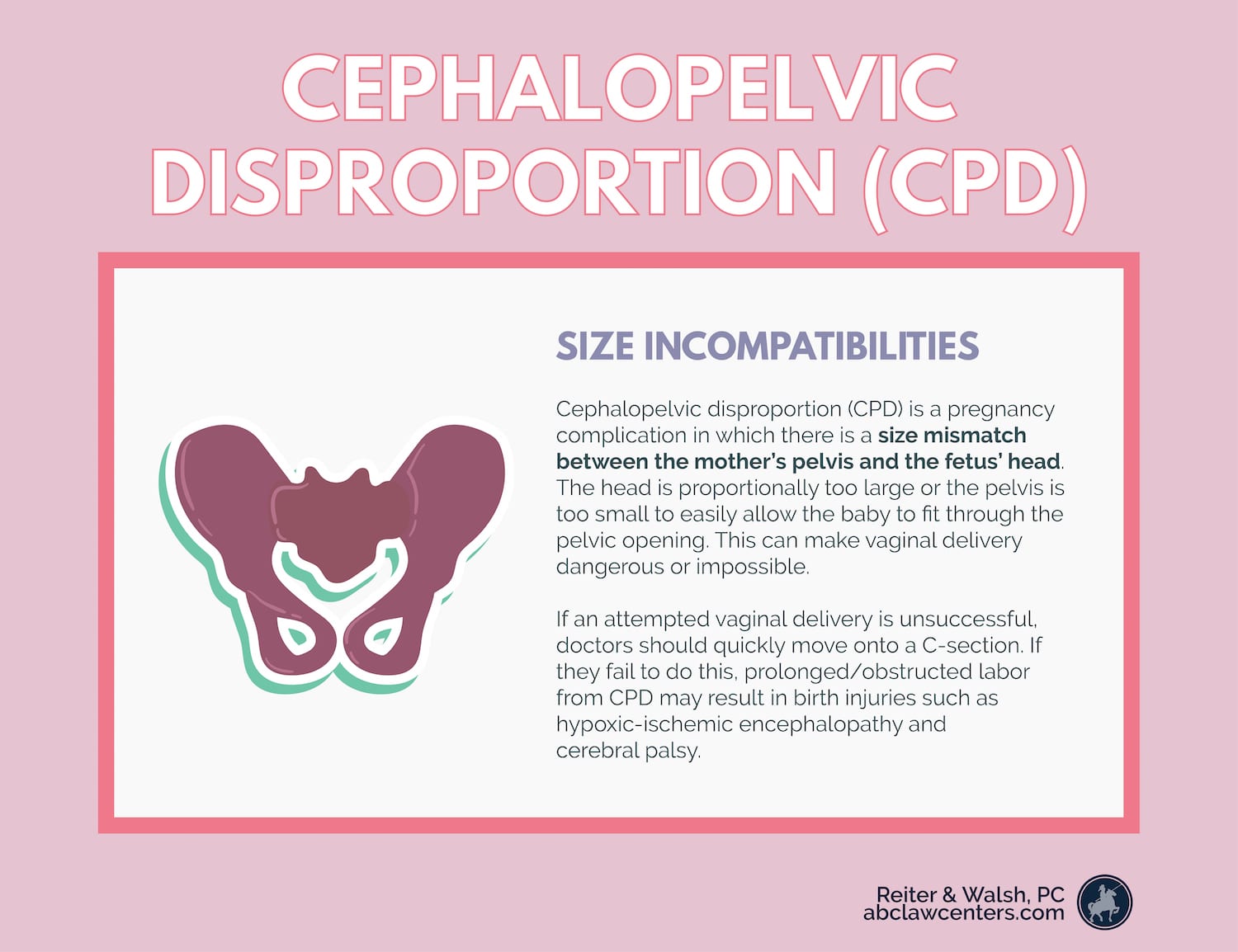 Cephalopelvic Disproportion Pathophysiology