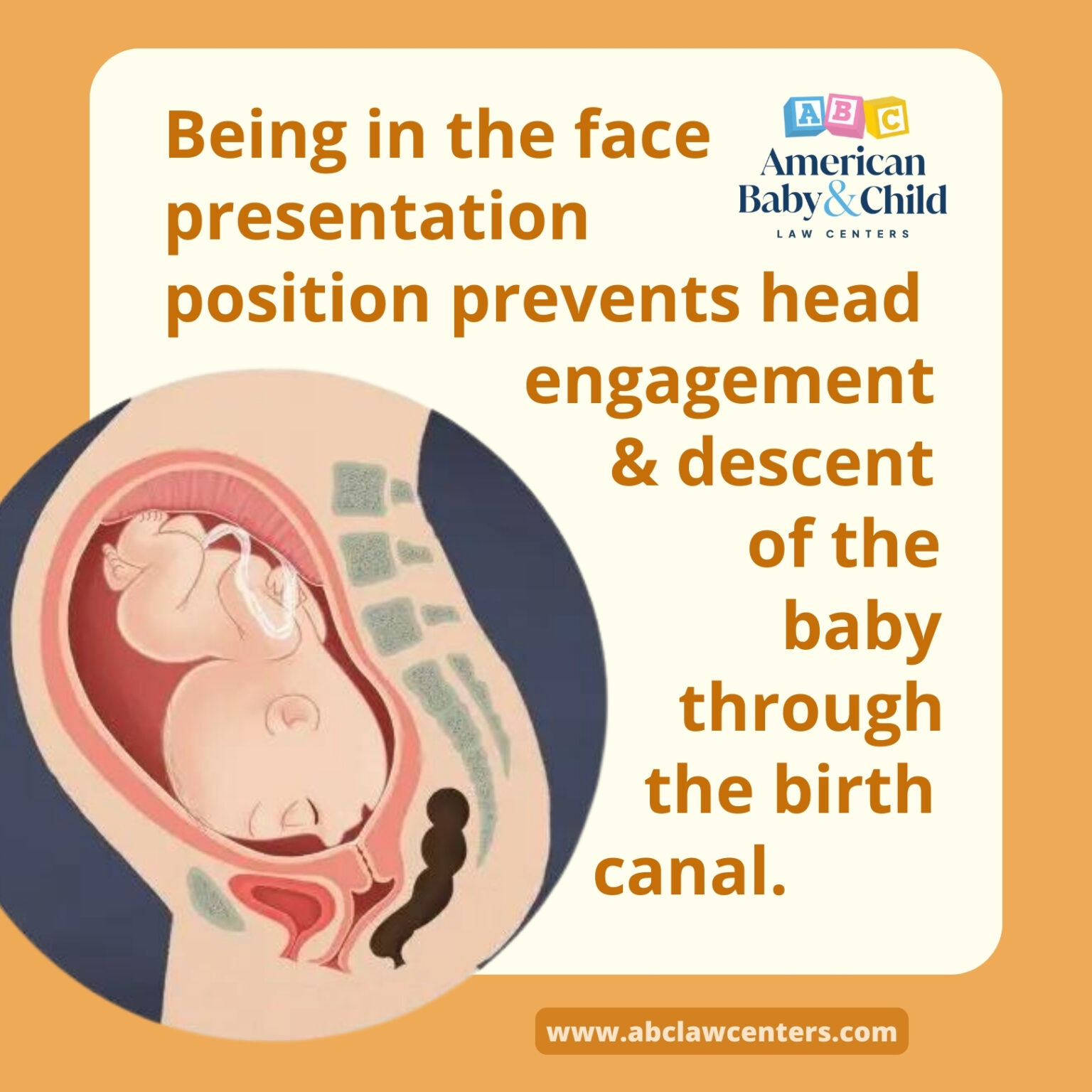 what causes face presentation birth