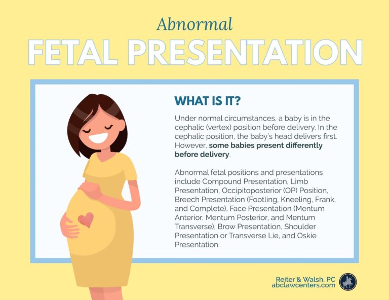 abnormal fetal presentation meaning