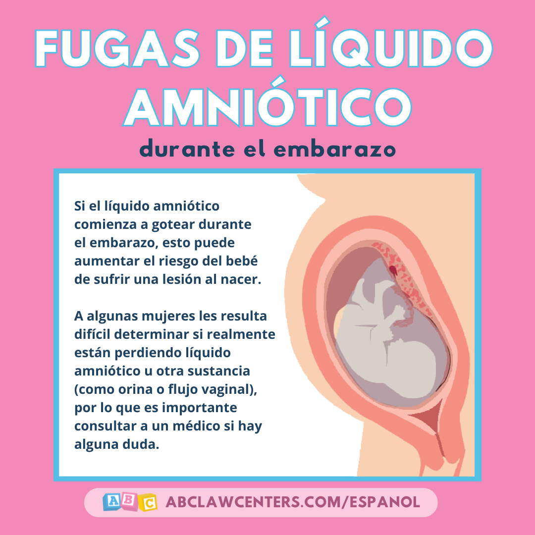 Fugas de líquido amniótico