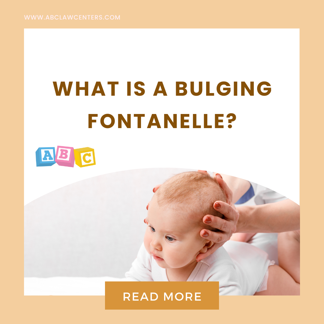 what is a bulging fontanelle?